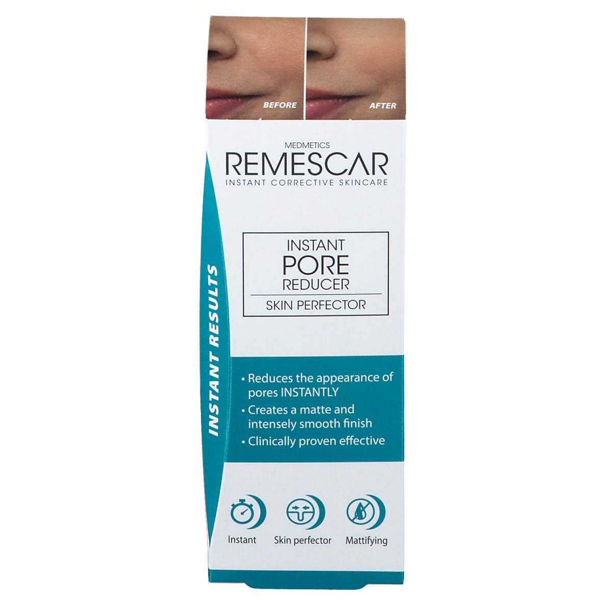 Verpakking met voor-na beelden. Opschrift: Remescar Instant Pore Reducer. Blauwe accenten.