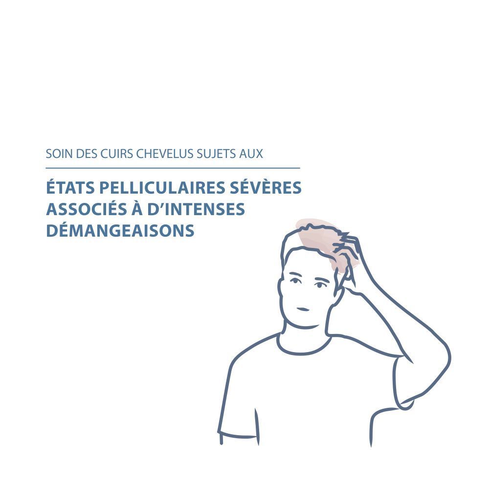 Homme se grattant la tête. Texte: Soin des cuirs chevelus sujets aux états pelliculaires sévères associés à d'intenses démangeaisons.