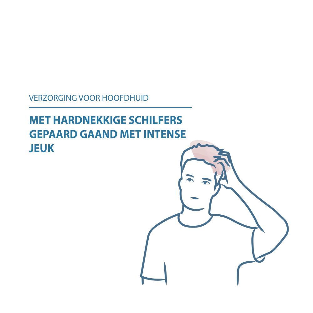 Man krabt aan zijn hoofd. Tekst: Verzorging voor hoofdhuid met hardnekkige schilfers gepaard gaand met intense jeuk.