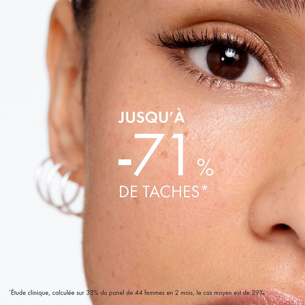 Close-up van een gezicht. Tekst: Tot -71% vlekken. Studie op 44 vrouwen.
