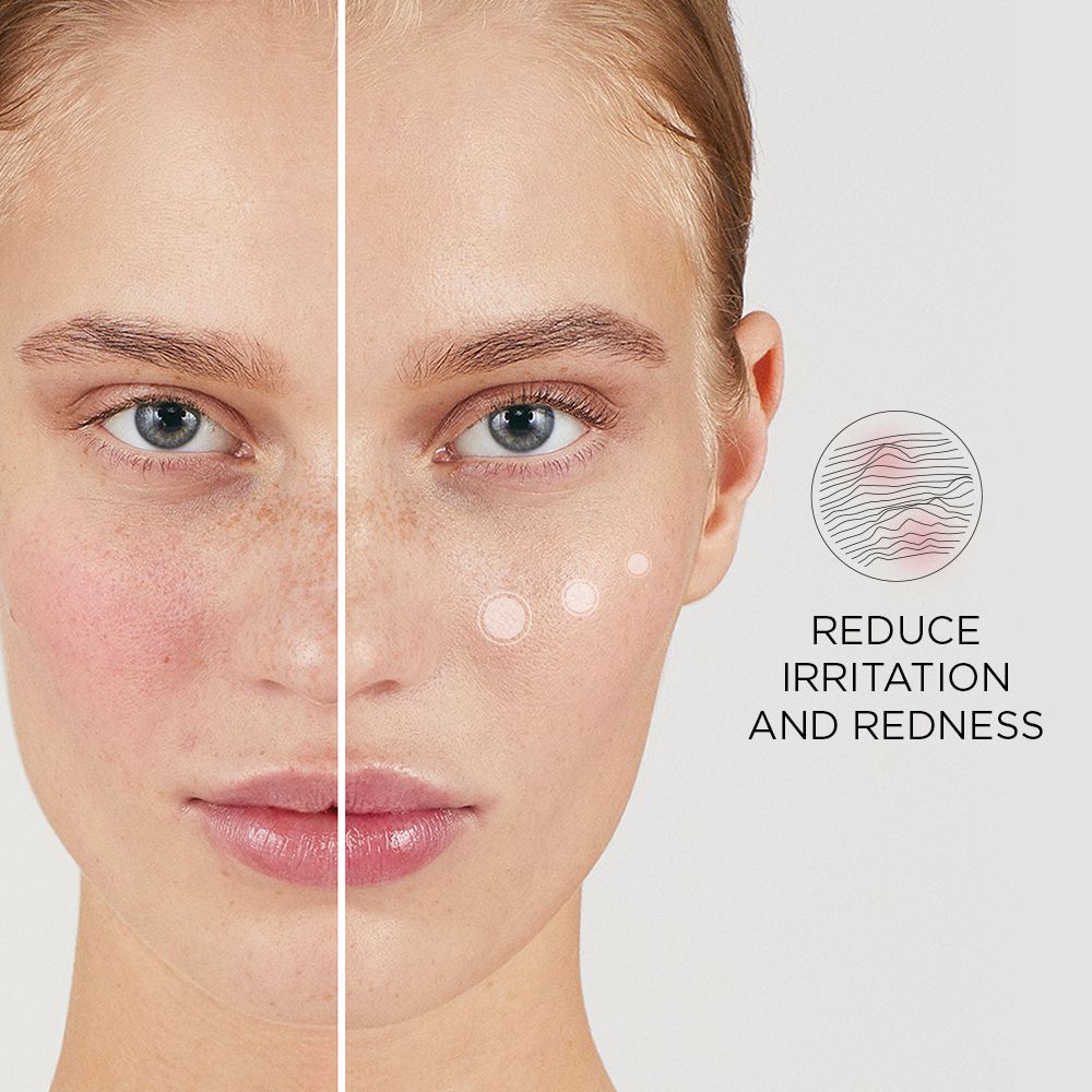 Gesichtshälfte mit Rötung, andere Hälfte ohne. Text: Reduce Irritation and Redness.