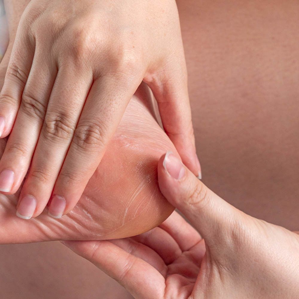Mains touchant un pied. Mise au point sur le talon. Peau avec signes de sécheresse.