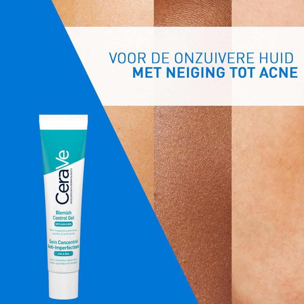 Producttube naast huidvoorbeelden. Voor de onzuivere huid met acne.