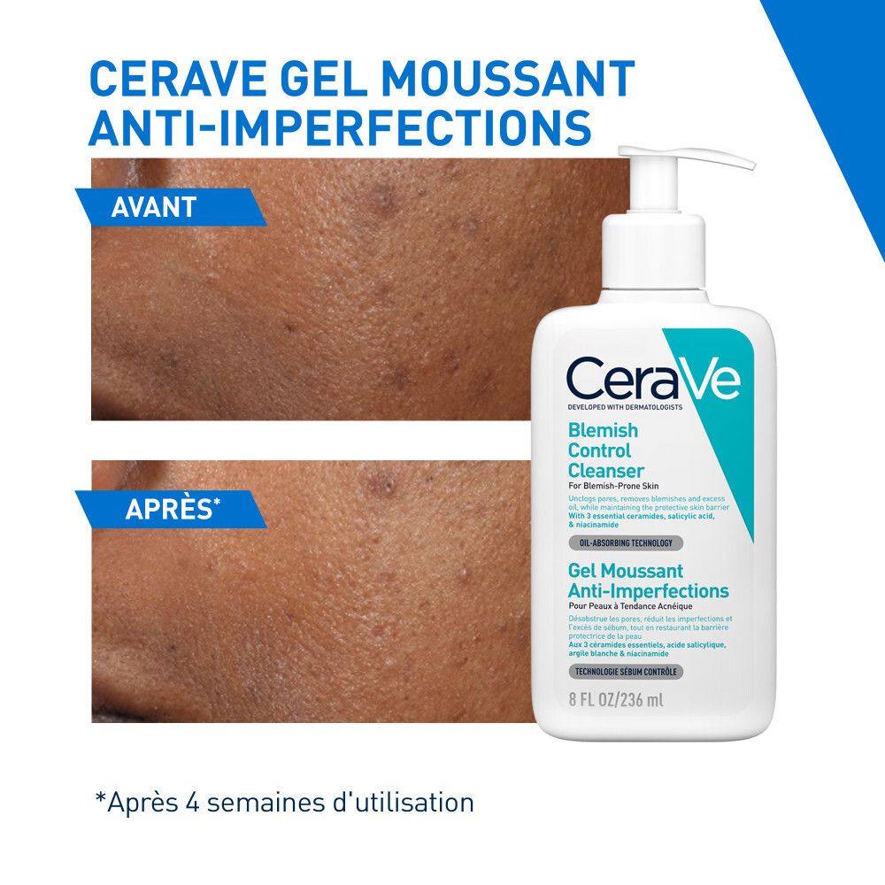 Images avant-après de la peau. Flacon: CeraVe Blemish Control Cleanser.
