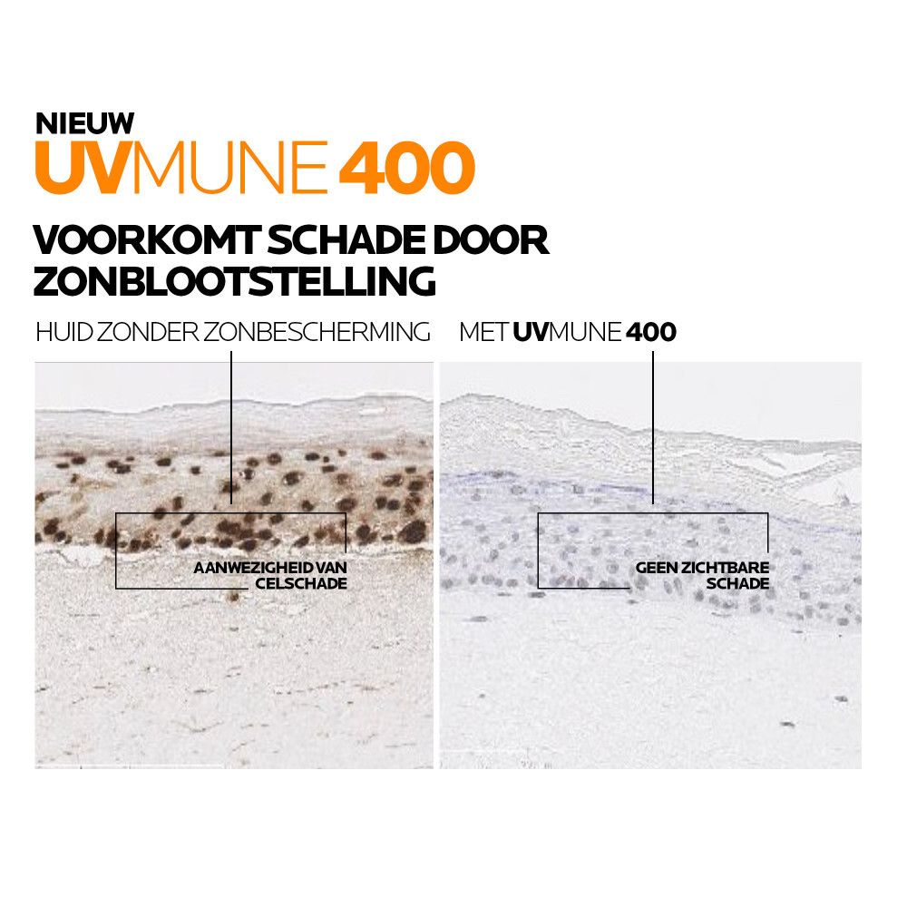 Vergelijking huid zonder en met zonnebescherming. Tekst: UVmune 400, voorkomt zonneschade.
