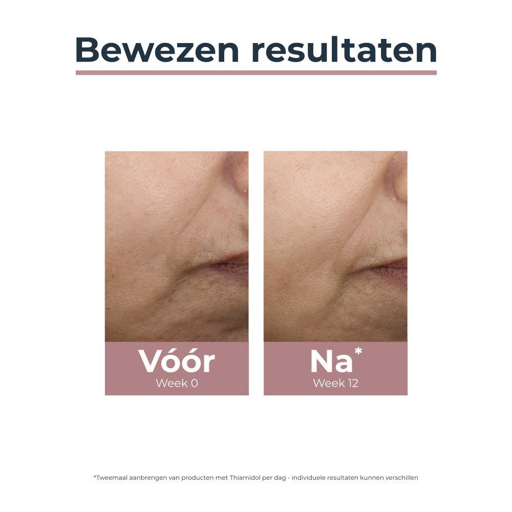 Voor- en nafoto's. Tekst: Resultaten na 12 weken. Eucerin Anti-Pigment.