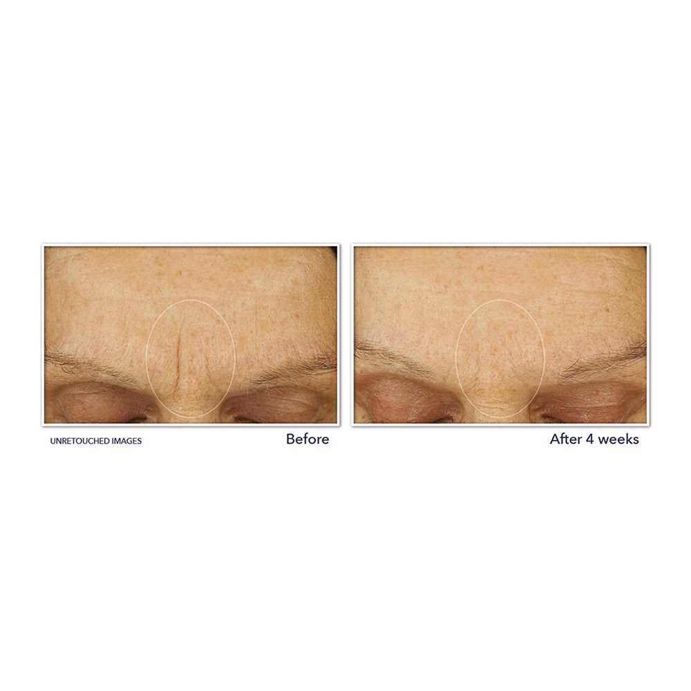 Pot de crème avec couvercle. Inscription RoC et Retinol Correxion. Volume : 50 ml.