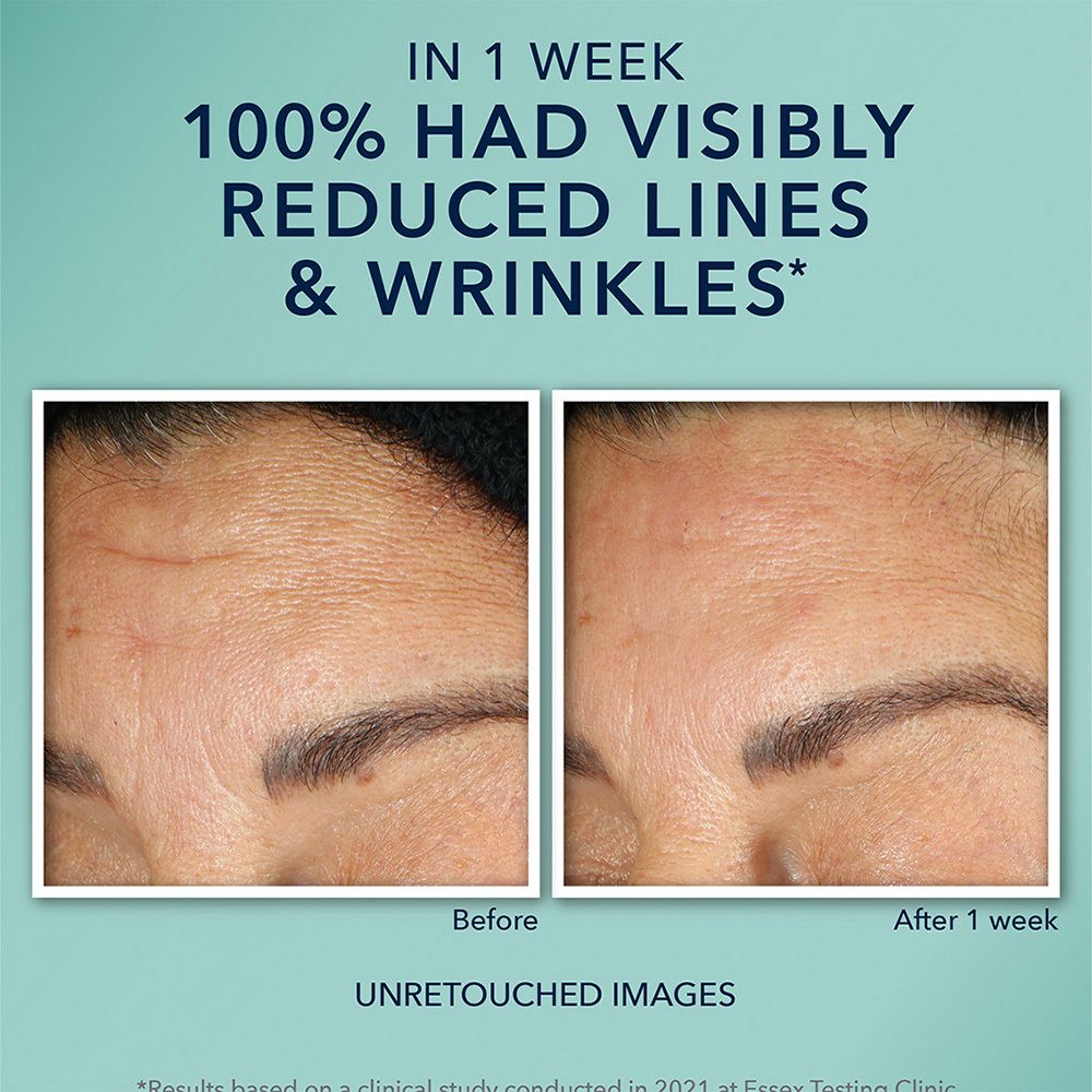 Afbeelding met product en tekst. Voor en na. Tekst: In 1 week had 100% zichtbaar minder lijntjes & rimpels.