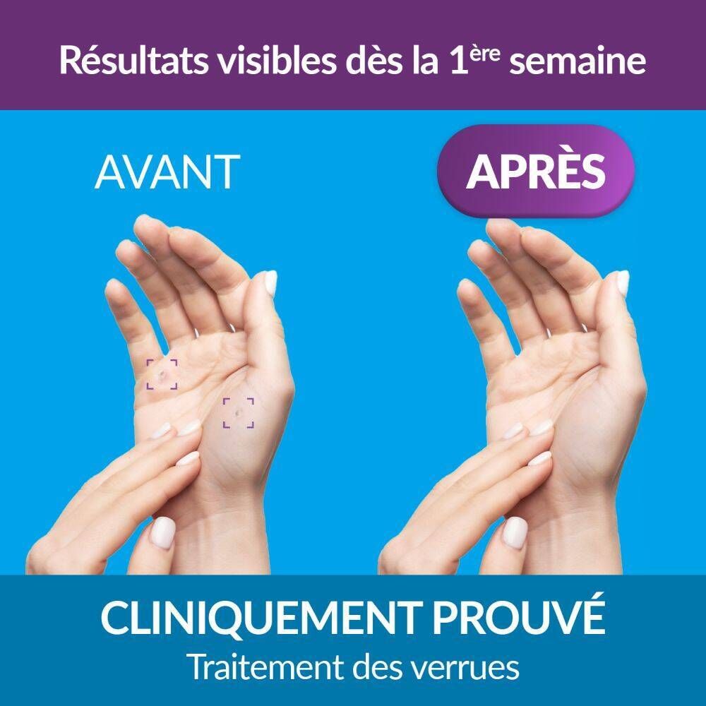 Emballage et flacon. Inscription: Excilor, traitement des verrues. Contient 4 ml.