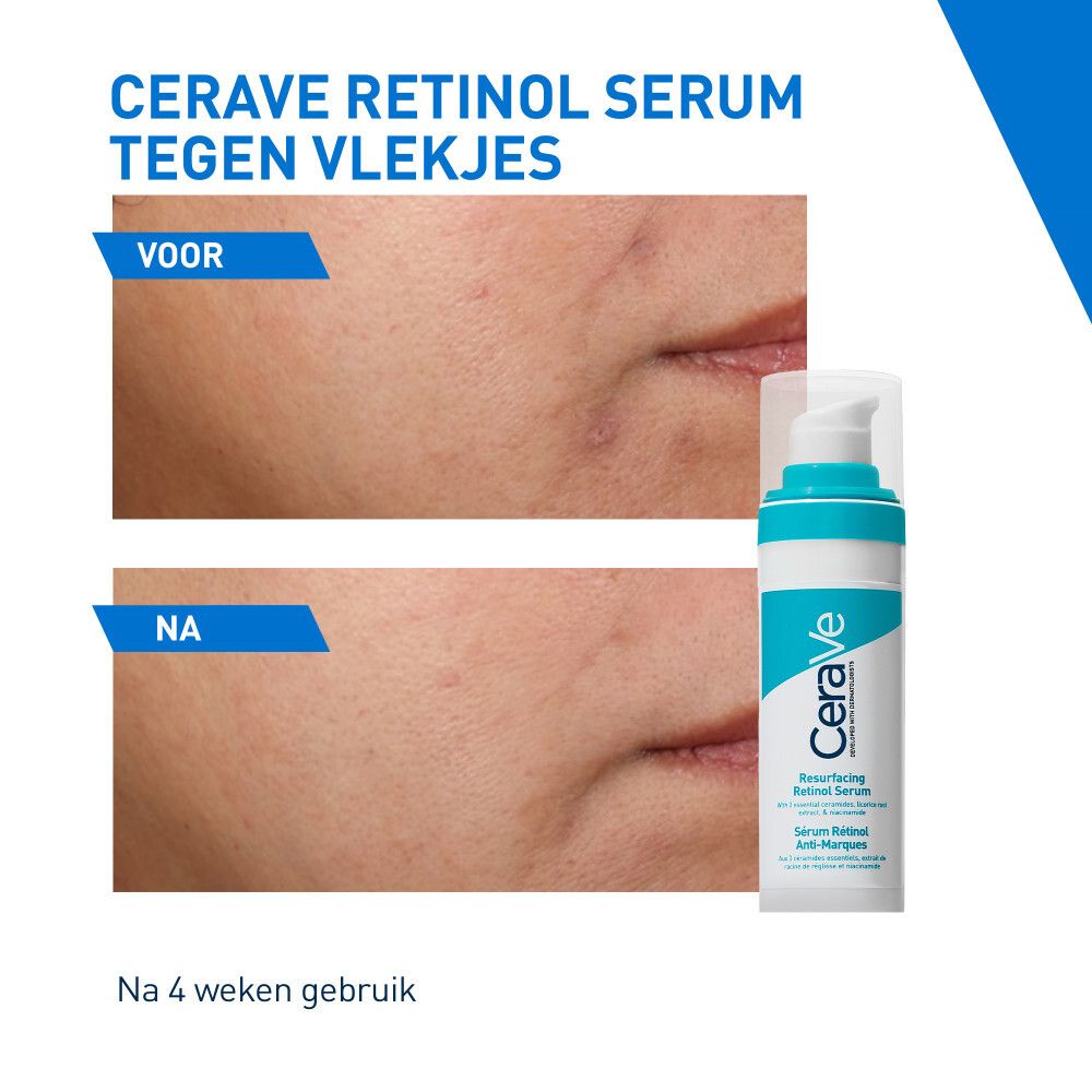 Voor- en na-afbeelding. Tekst: CeraVe Retinol Serum tegen vlekjes. Na 4 weken gebruik.