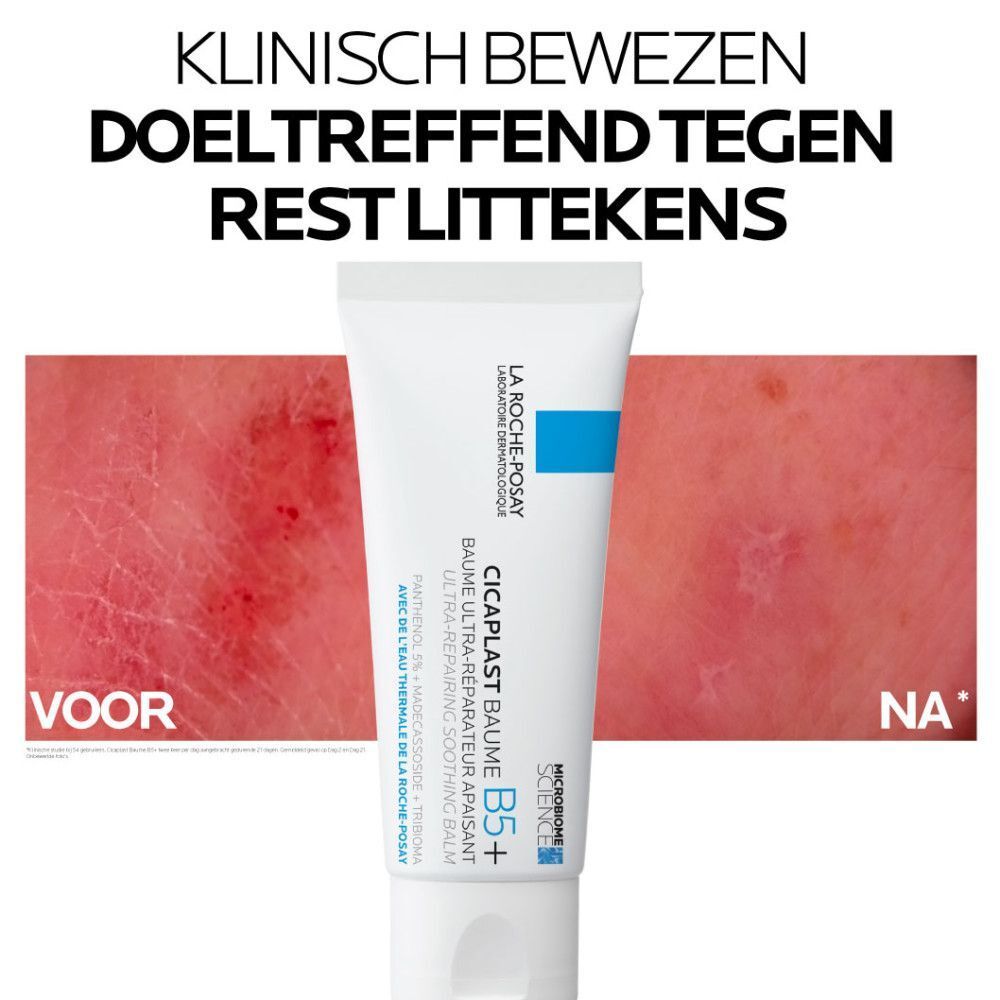 Voor-en-na-afbeelding. Tekst: Cicaplast Baume B5+. Productnaam en merk zichtbaar.