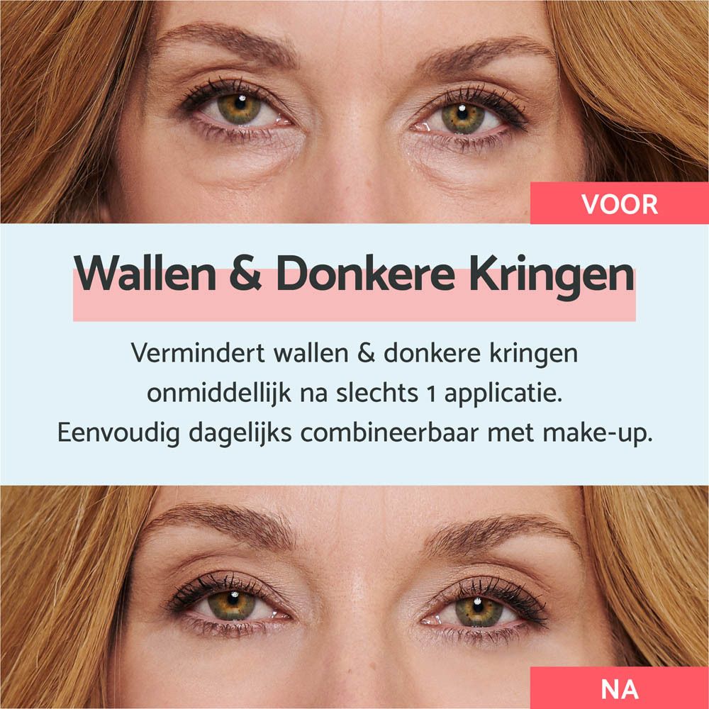 Voor/na foto. Tekst: wallen & donkere kringen. Vermindert wallen & donkere kringen. Eenvoudig met make-up.