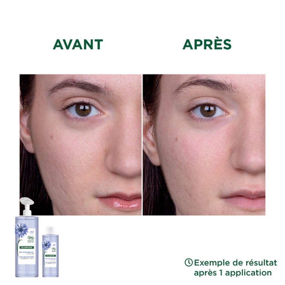 Klorane Eau Micellaire 3-en-1. Comparaison avant-après. Visage.