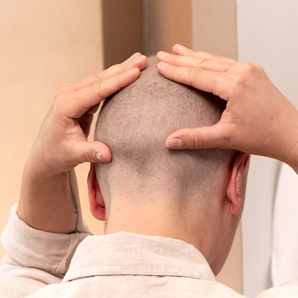 Personne touchant le cuir chevelu avec les mains. Cuir chevelu rasé. Fond beige.