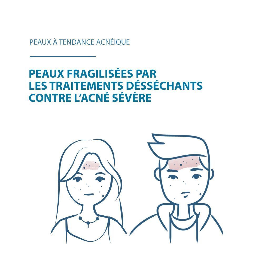 Illustration de deux personnes avec imperfections cutanées. Texte en français.