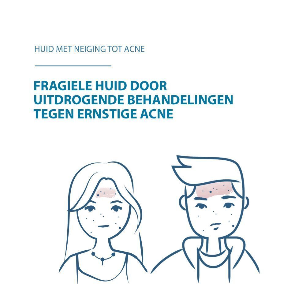 Illustratie van twee personen met huidonzuiverheden. Nederlandse tekst.