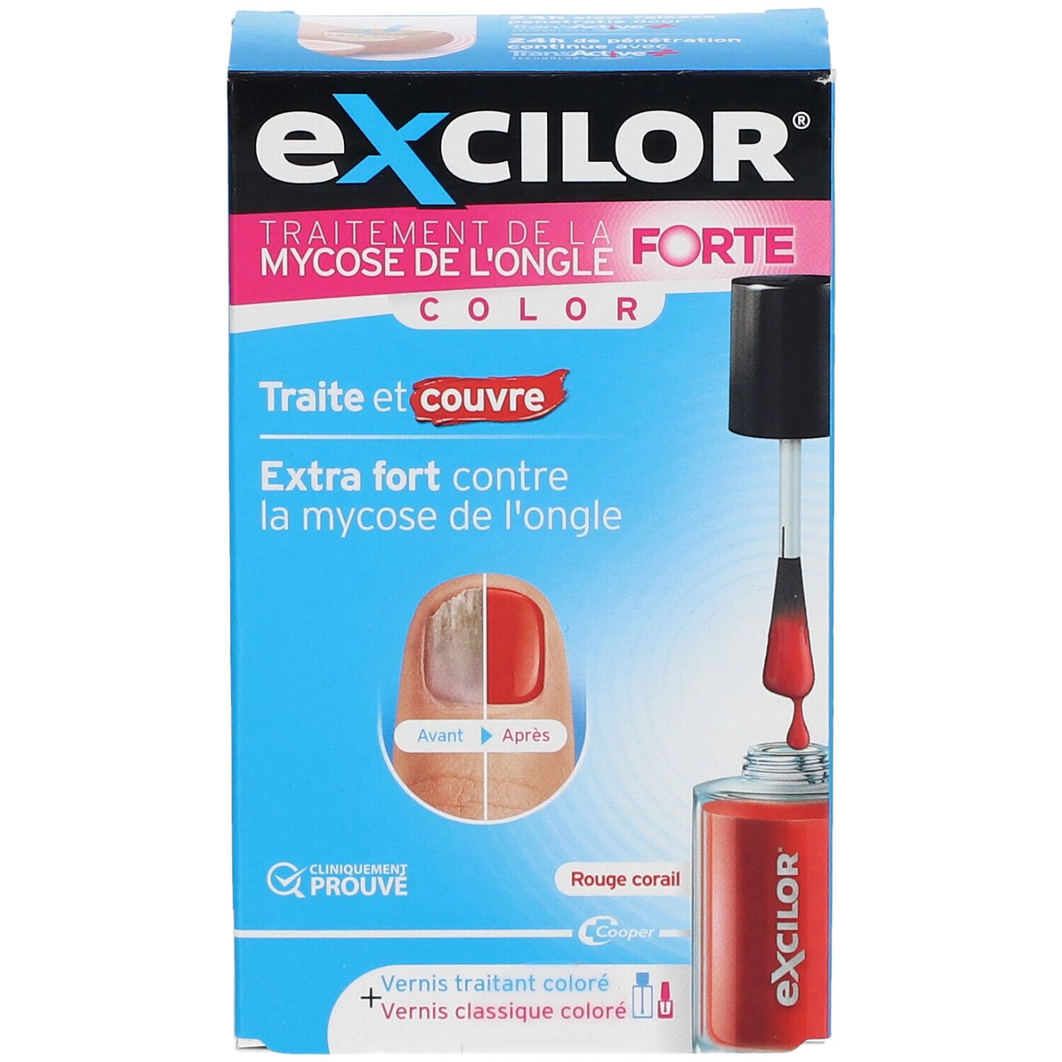 Excilor Forte, behandeling schimmelnagels. Koraalrood. Voor/Na. Klinisch bewezen.
