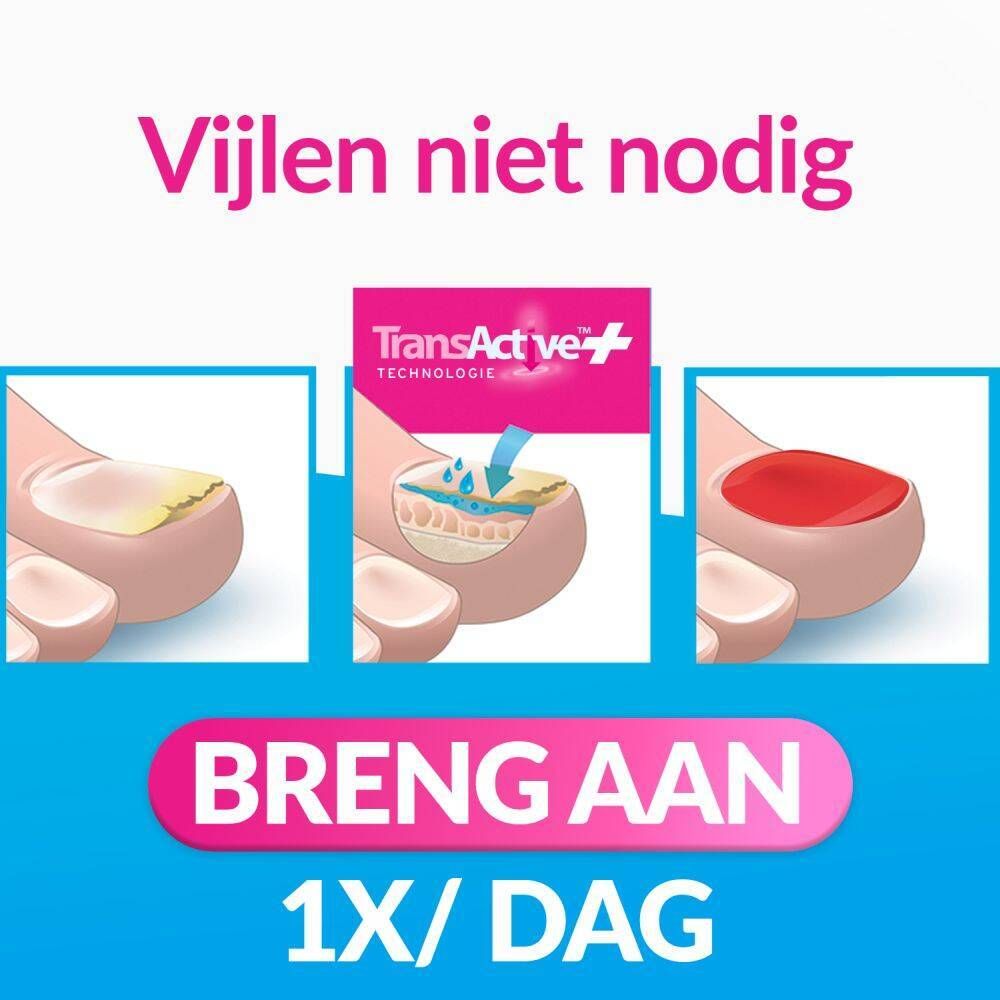 Toepassing: 1x per dag. Aanbrengen op de geïnfecteerde nagel. Stapsgewijze instructies.