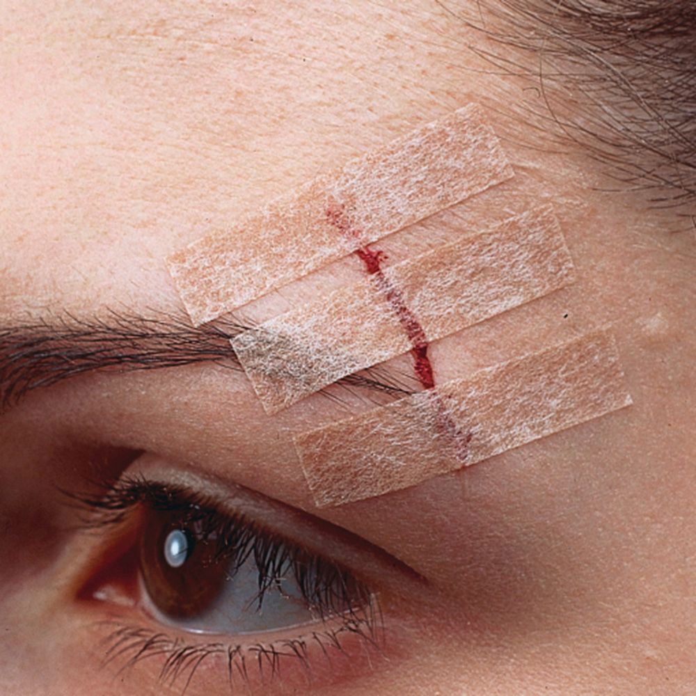 Nexcare Steri-Strip. 6 sutures cutanées. Bandes couleur peau. 6 mm x 75 mm. Boîte.