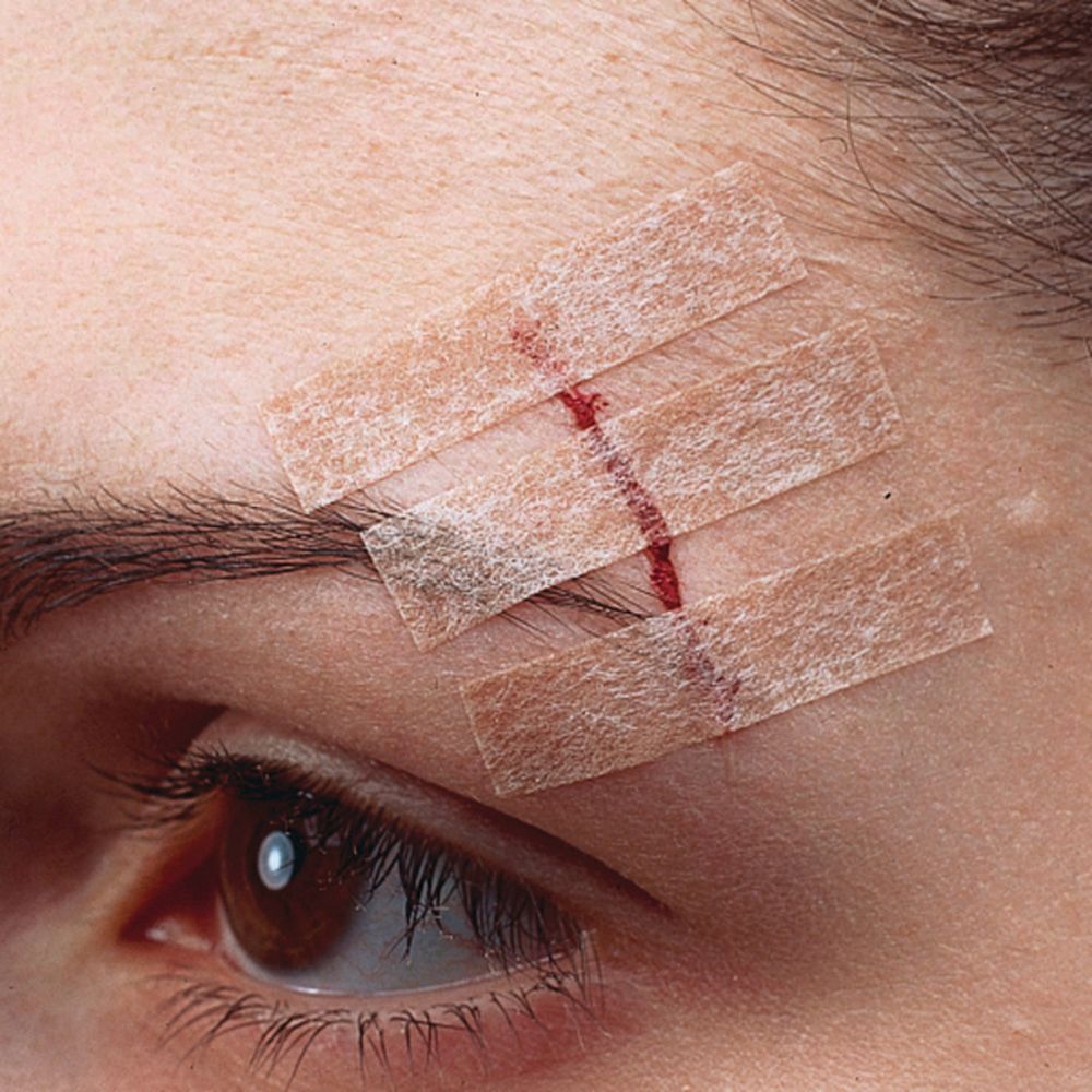 Nexcare Steri-Strip. 6 sutures cutanées. Bandes couleur peau. 6 mm x 75 mm. Boîte.