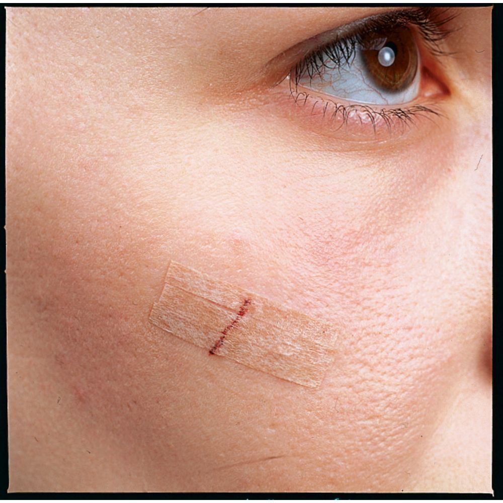 Nexcare Steri-Strip. 6 sutures cutanées. Bandes couleur peau. 6 mm x 75 mm. Boîte.