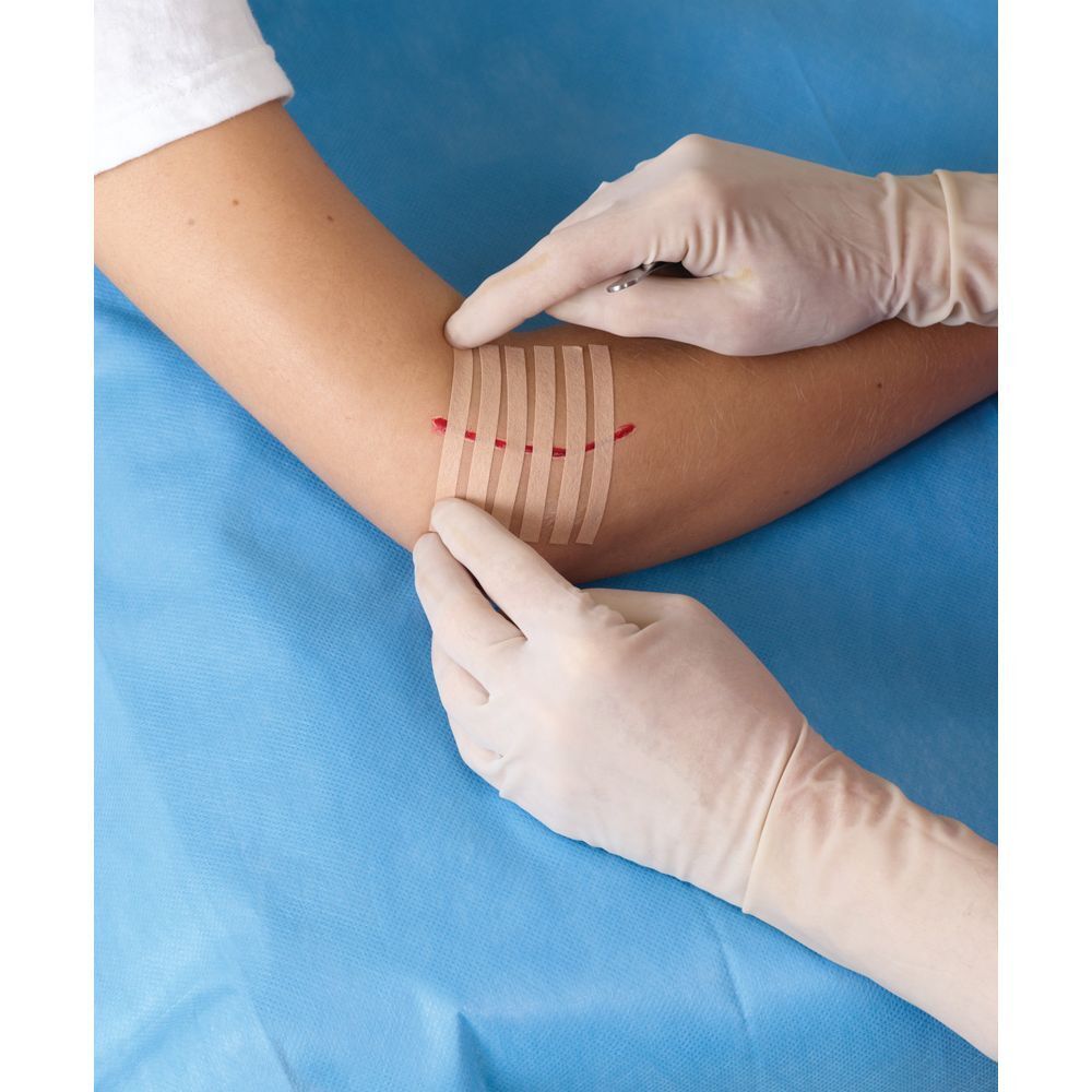 Nexcare Steri-Strip. 6 sutures cutanées. Bandes couleur peau. 6 mm x 75 mm. Boîte.