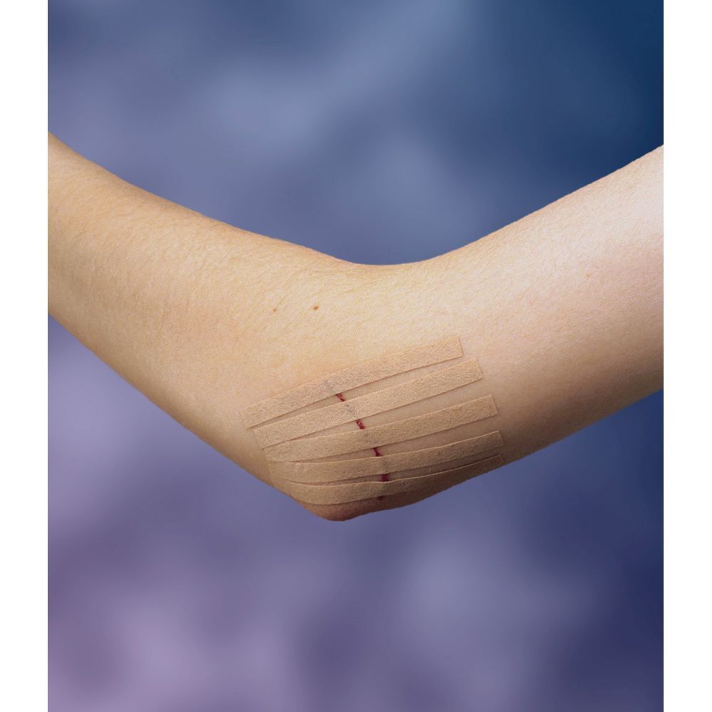 Nexcare Steri-Strip. 6 sutures cutanées. Bandes couleur peau. 6 mm x 75 mm. Boîte.