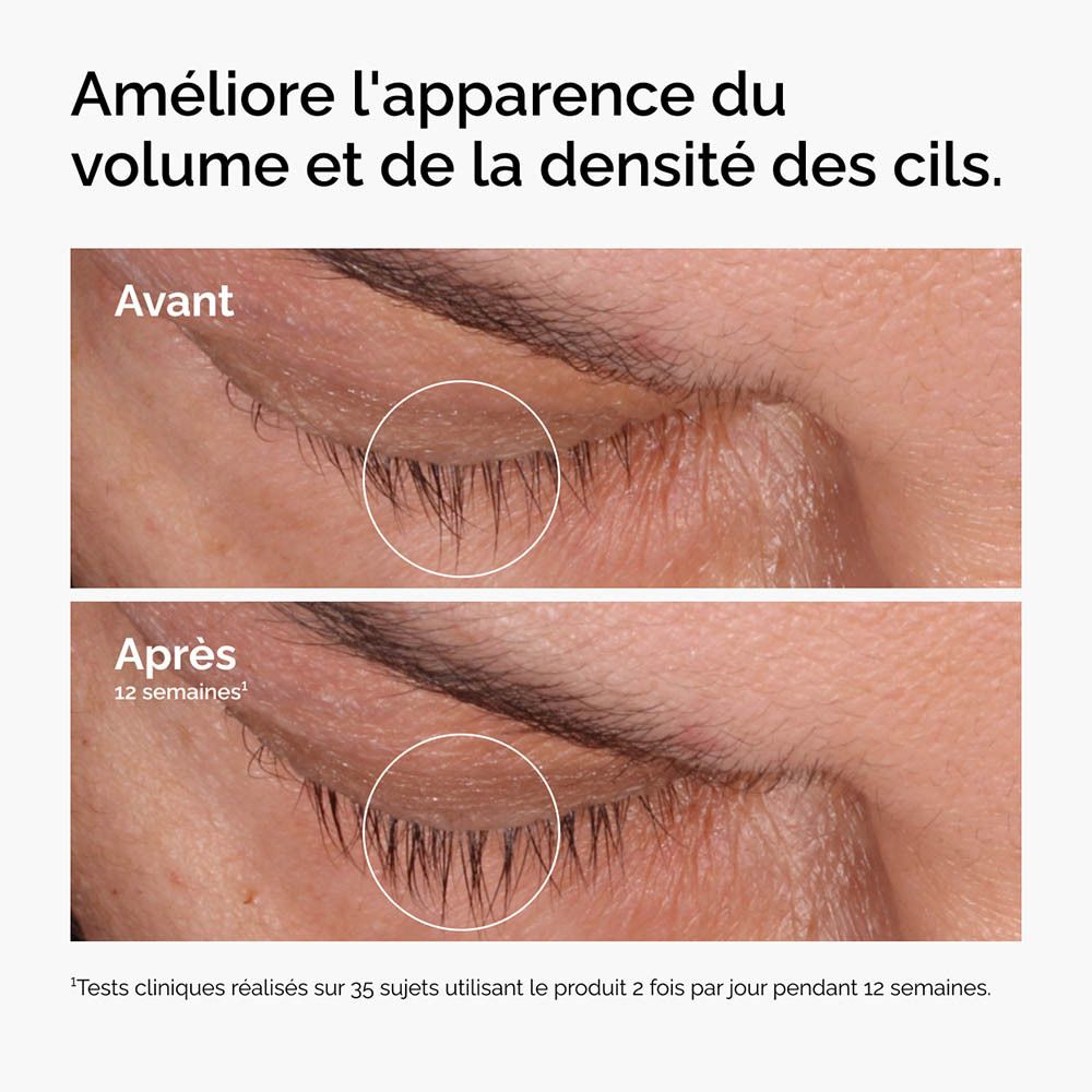 Comparaison des cils avant et après 12 semaines. Amélioration de la densité.
