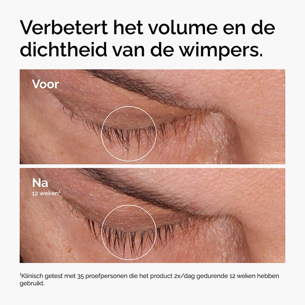 Vergelijking van wimpers voor en na 12 weken. Verbetering van de dichtheid.