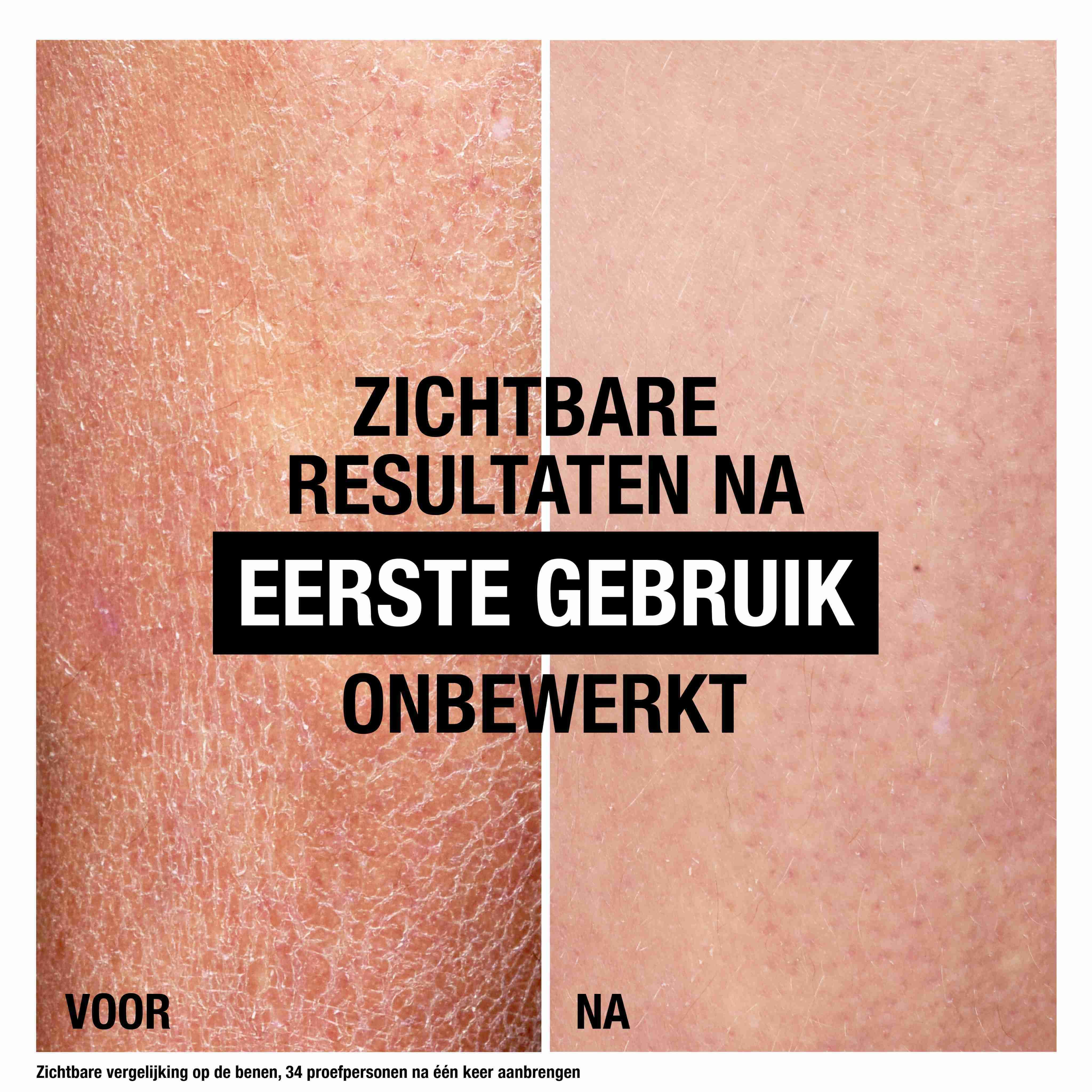 Voor-en-na vergelijking. Tekst: Zichtbare resultaten na eerste gebruik. Droge huid wordt gehydrateerd.