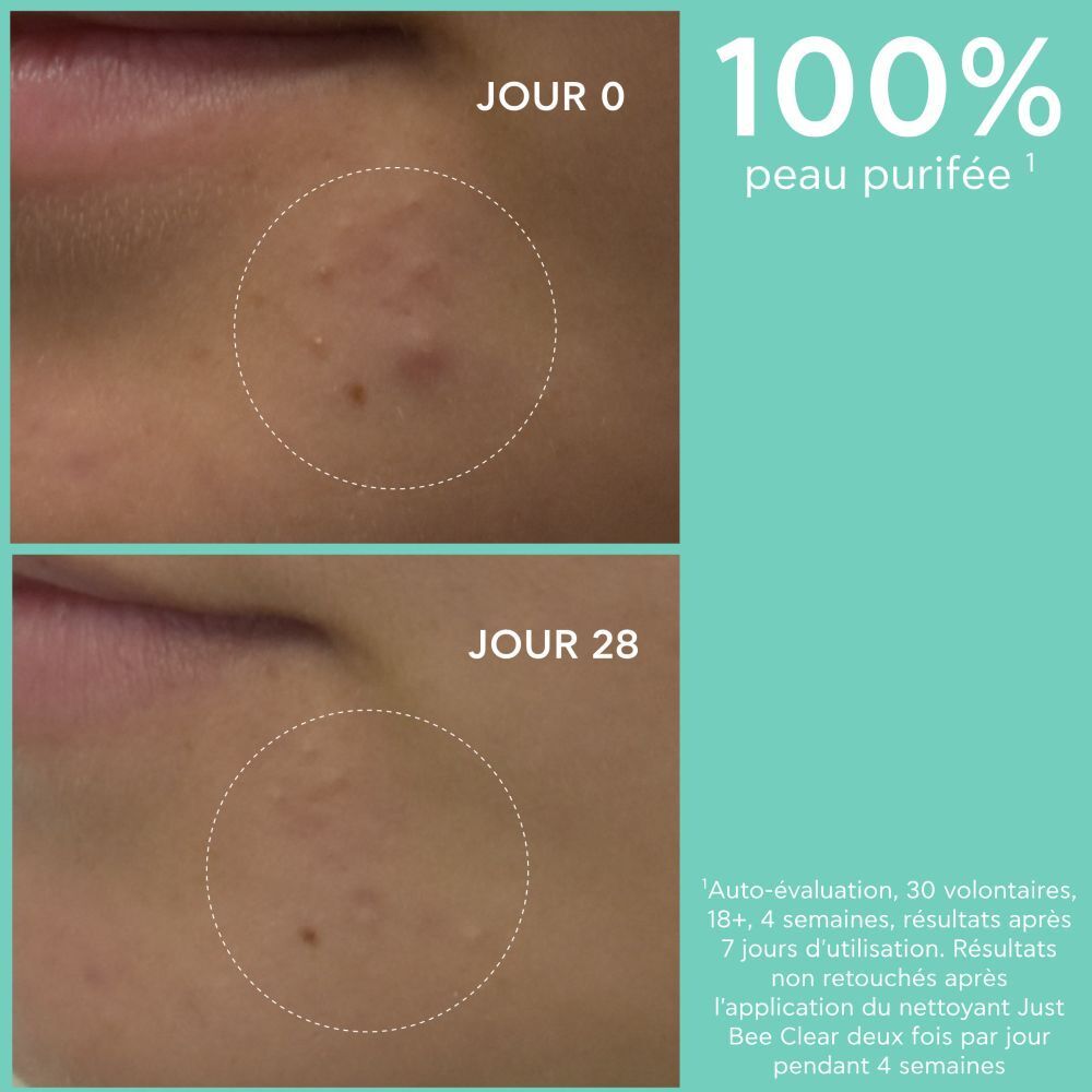 Apivita Just Bee Clear Gel Nettoyant Purifiant