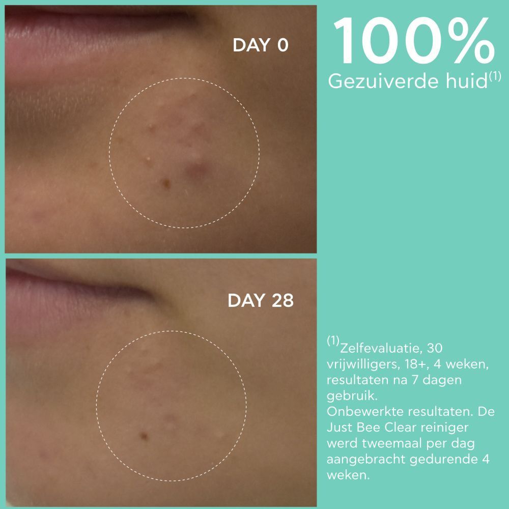 Apivita Just Bee Clear Purifying Cleansing Gel