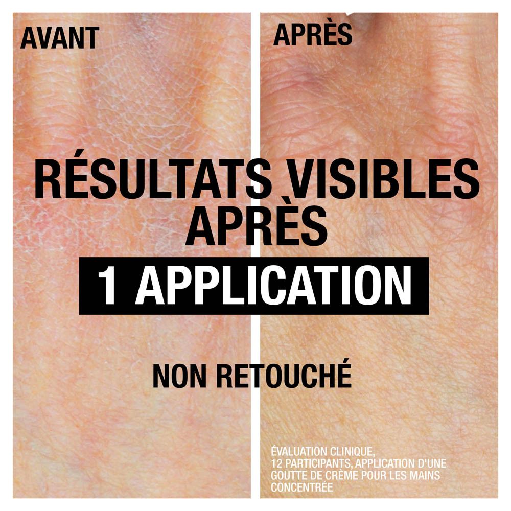 Comparaison avant/après. Peau sèche avant, peau améliorée après 1 application. Texte: Résultats visibles.