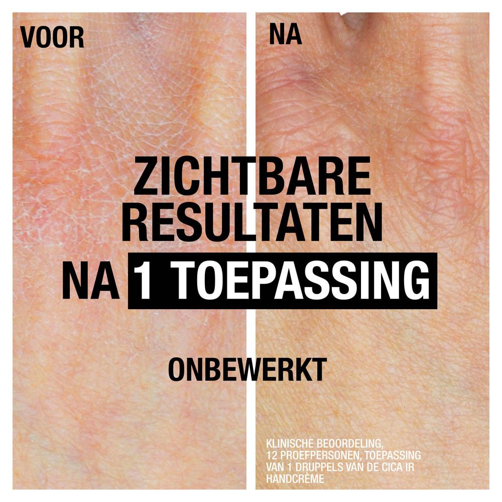 Voor-na vergelijking. Droge huid voor, verbeterde huid na 1 toepassing. Tekst: Zichtbare resultaten.