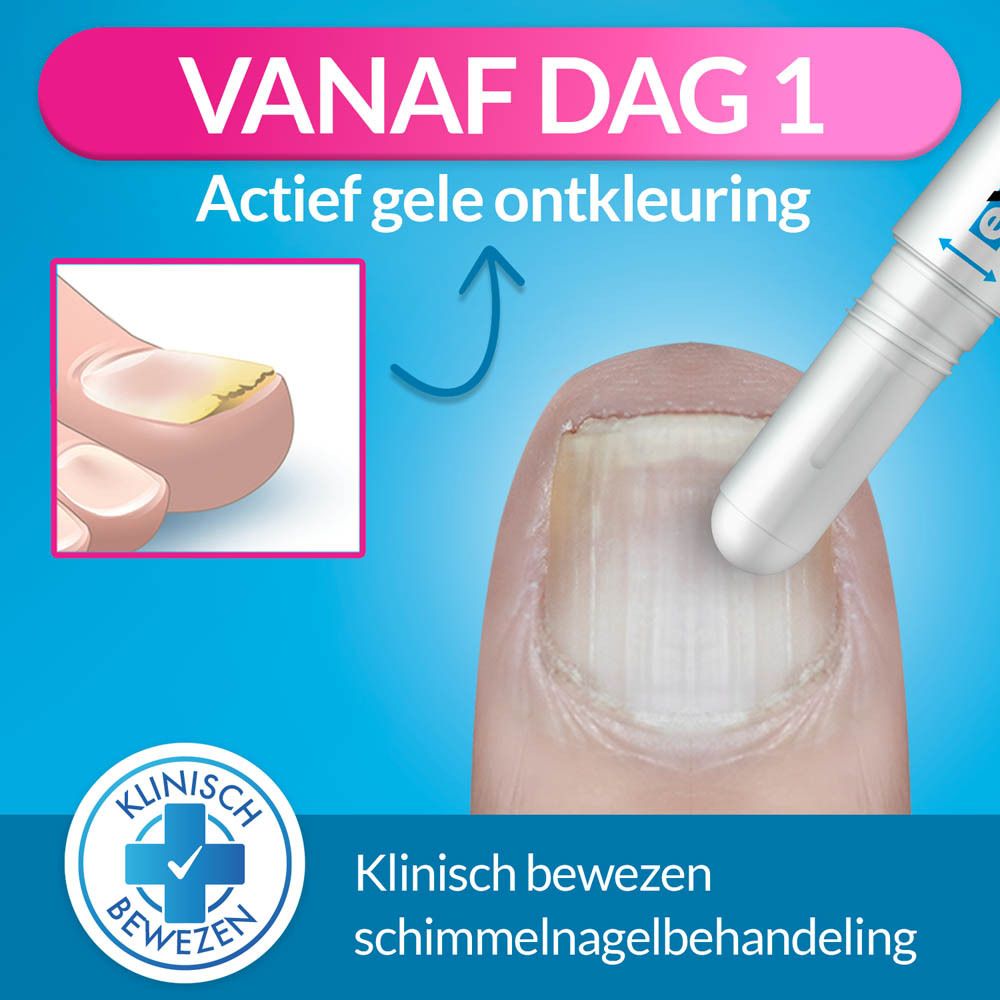Exilor Nagelverzorging: Actieve vergeling vanaf dag 1. Klinisch bewezen behandeling van schimmelnagels.