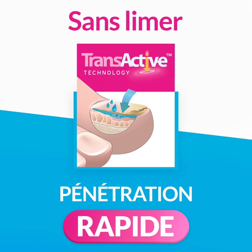 Illustration montrant la pénétration rapide de la technologie TransActive dans un ongle infecté.