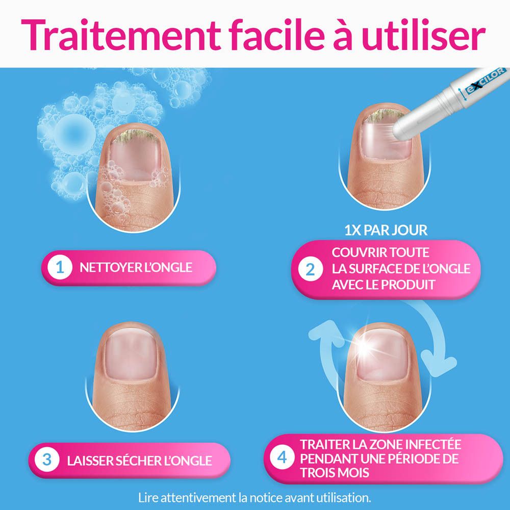 Instructions pour l'application d'Excilor pour le traitement des mycoses des ongles : Nettoyer, Appliquer, Sécher, Traiter.