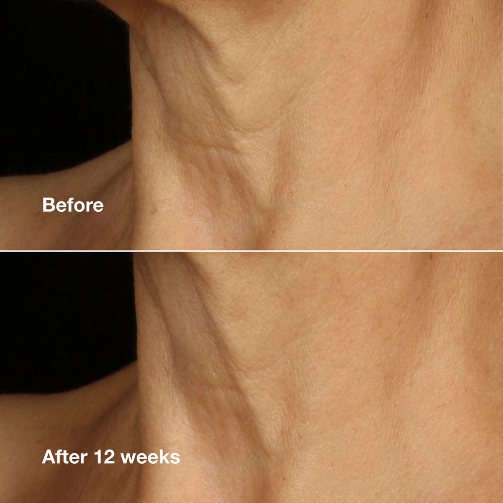 Clinique Smart Clinical Repair™ Lifting Face + Neck Cream
