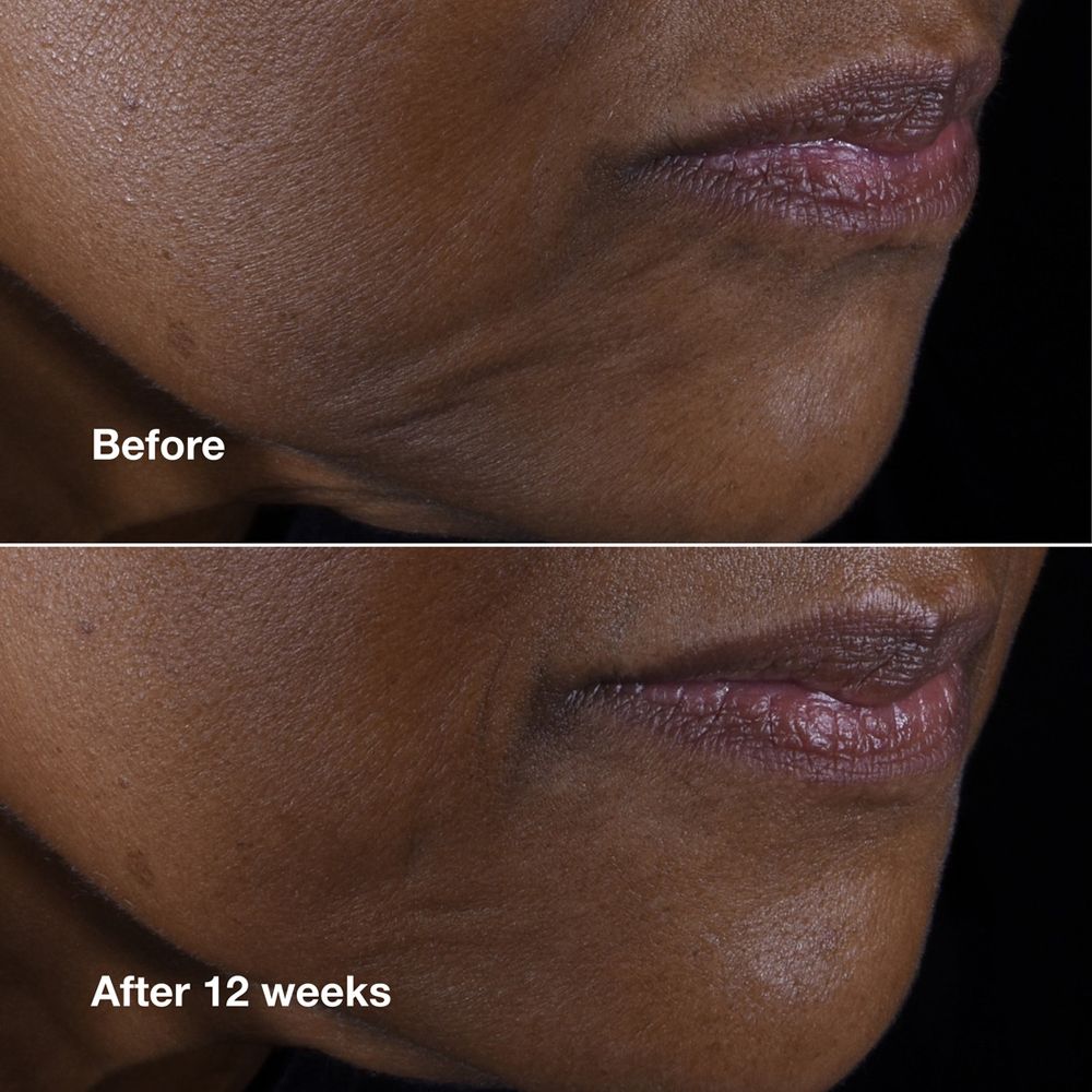 Clinique Smart Clinical Repair™ Lifting Face + Neck Cream