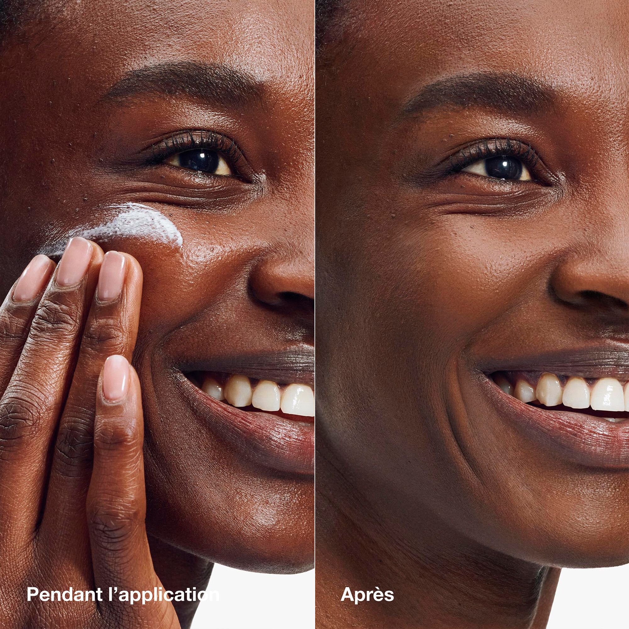 Gesicht einer Person, die Sonnencreme aufträgt. Vergleich Vorher/Nachher. Haut wirkt glatter.