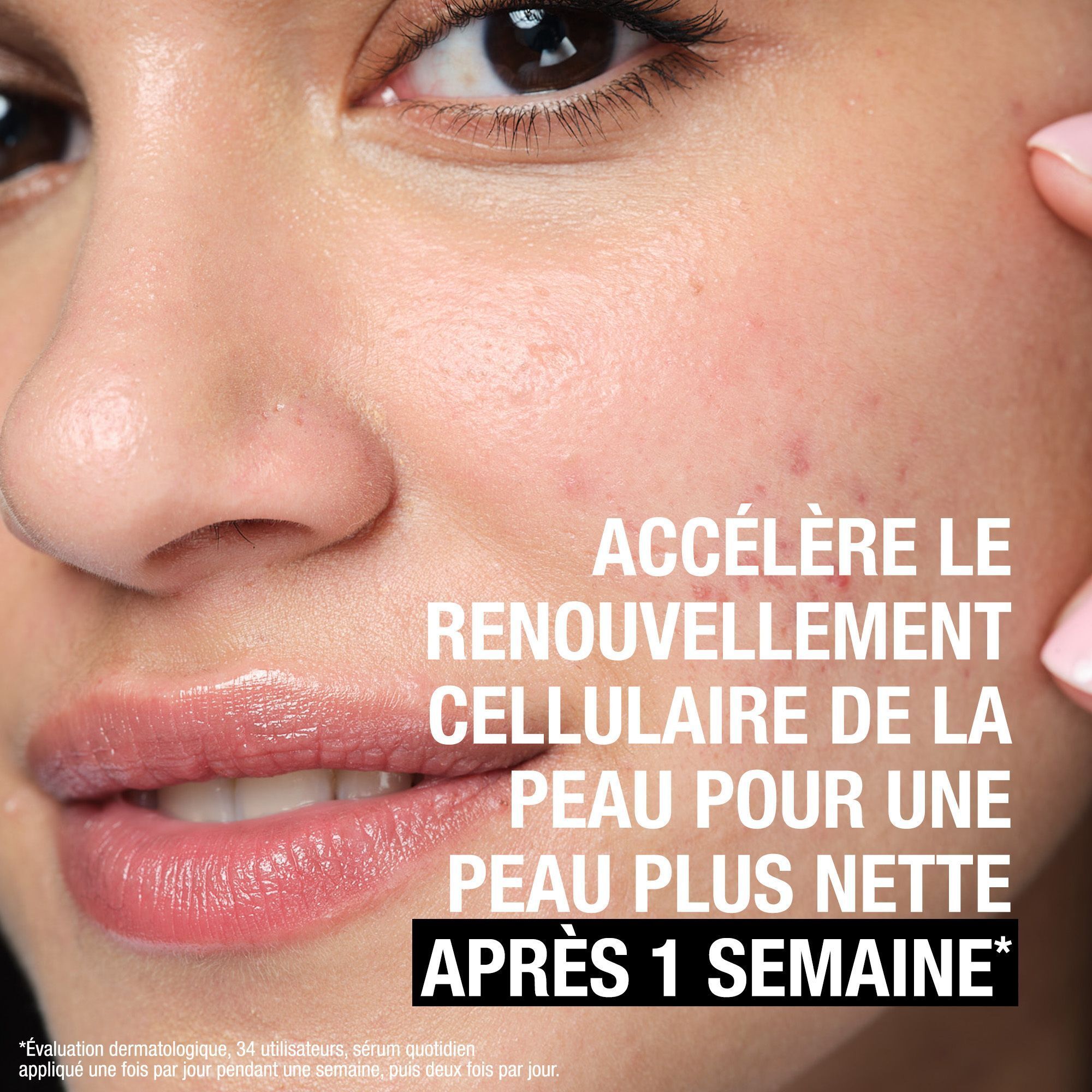 Visage d'une femme. Texte: Accélère le renouvellement cellulaire pour une peau plus nette après 1 semaine.