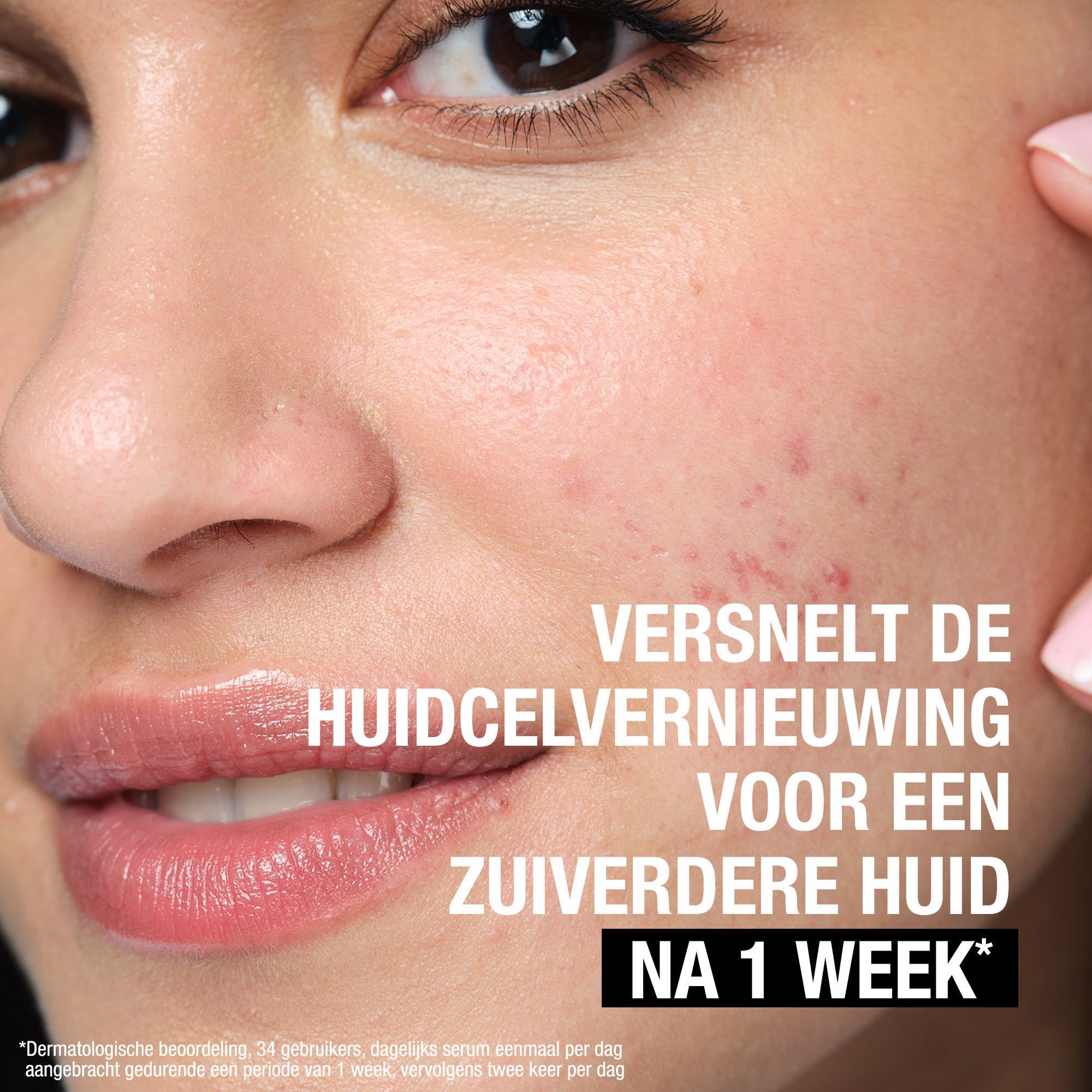 Gezicht van een vrouw. Tekst: Versnelt celvernieuwing voor een zuiverdere huid na 1 week.