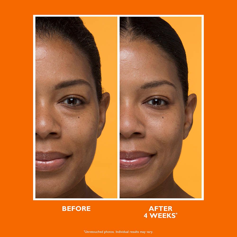 Image avant-après. Femme avec changements de peau après 4 semaines. Texte : BEFORE, AFTER 4 WEEKS.