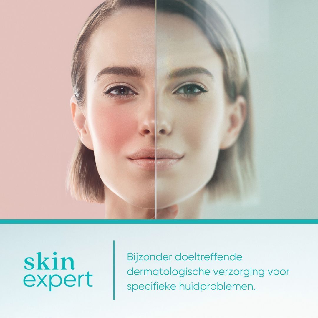 Skin Expert Carbamide Forte 18% Urée voetcrème in witte verpakking. Turkoois gedeelte met productinformatie.