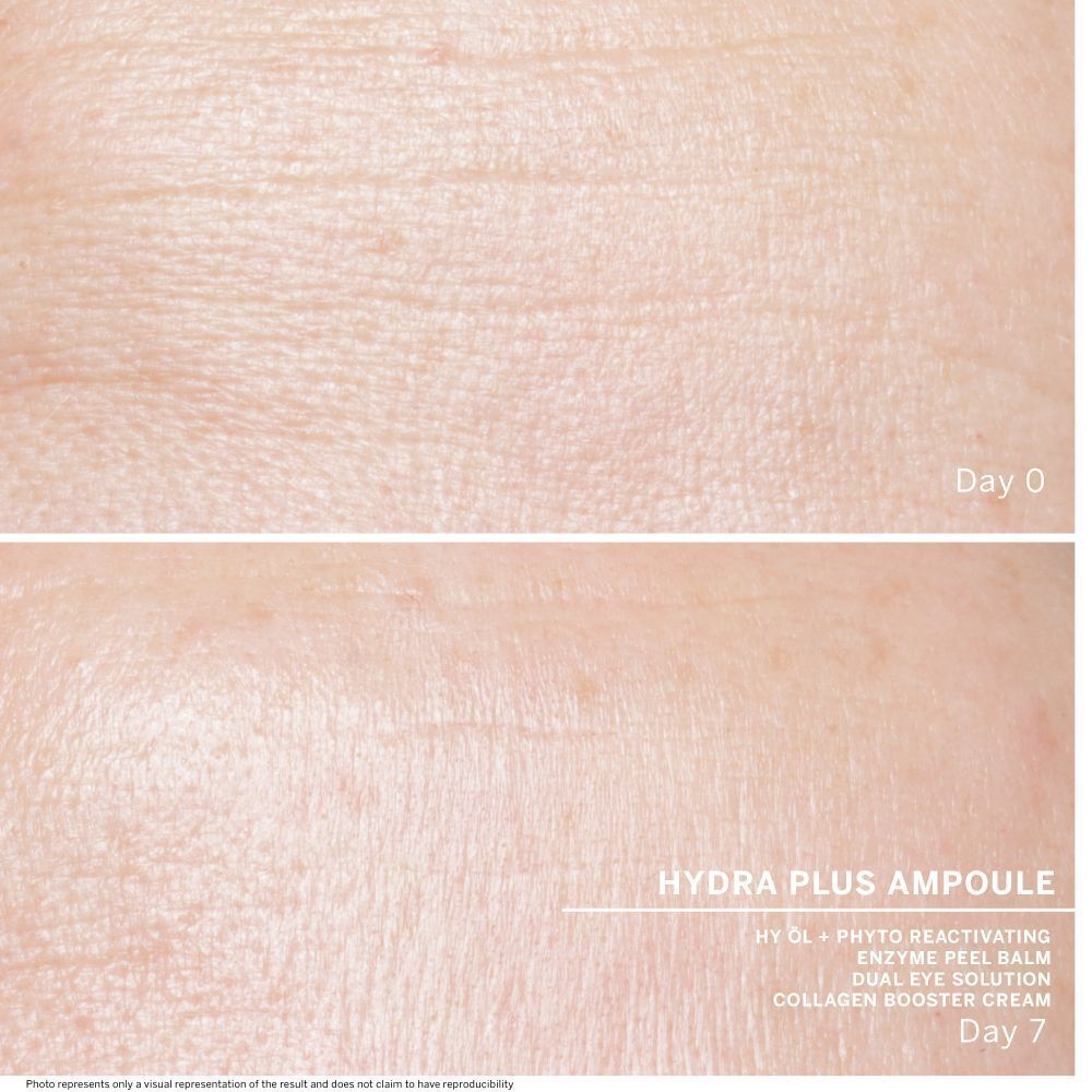 Zwei Hautbilder, Tag 0 und Tag 7. Text: Hydra Plus Ampulle, Hy Ol, Enzyme Peel Balm, Dual Eye Solution, Collagen Booster Cream.