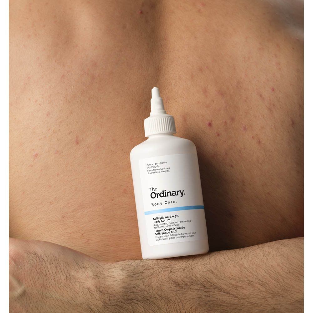 Weiße Flasche vor einem Rücken mit Hautunreinheiten. Aufschrift: The Ordinary Body Care, Salicylsäure 0,5 %.