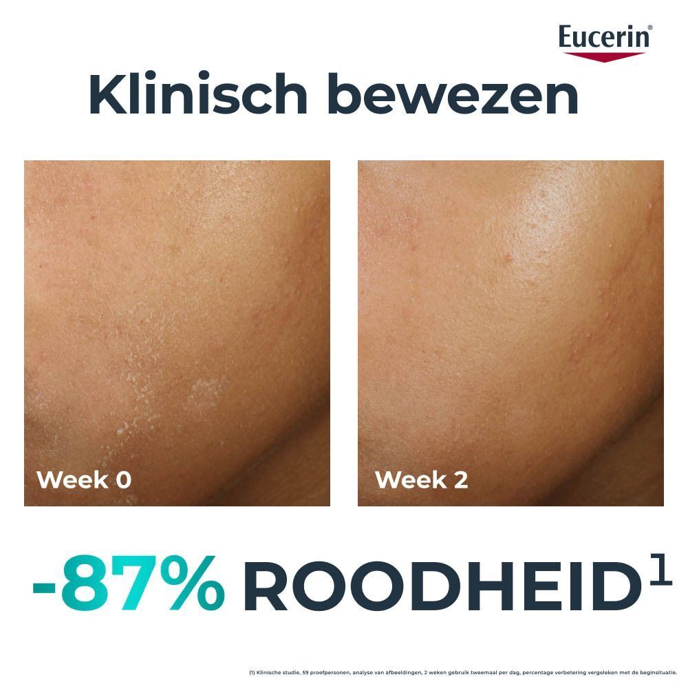 Eucerin DERMOPURE CLINICAL Hydra Repair Fluide Matifiant tube en verpakking. Wit, blauw, rood. 40 ml.