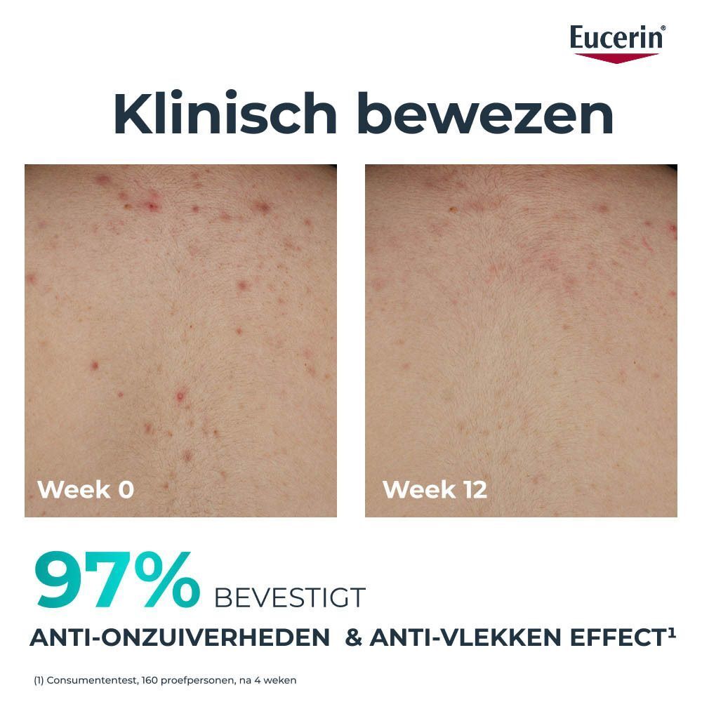 Huid voor en na gebruik. Tekst: 97% bevestigen anti-onzuiverheden & anti-vlekken effect.