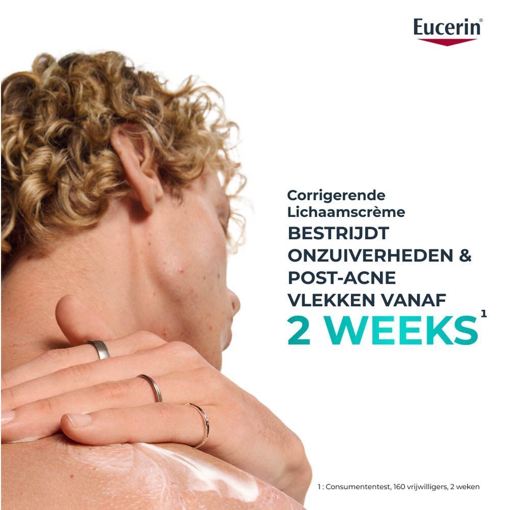 Man met crème op rug. Tekst: Corrigerende Lichaamscrème. Bestrijdt onzuiverheden & post-acne vlekken.