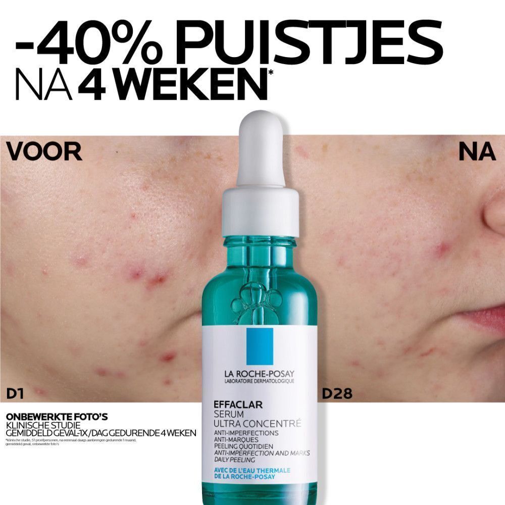 Voor- en na-afbeelding. Gezicht met puistjes. Tekst: -40% puistjes na 4 weken. Serumfles.